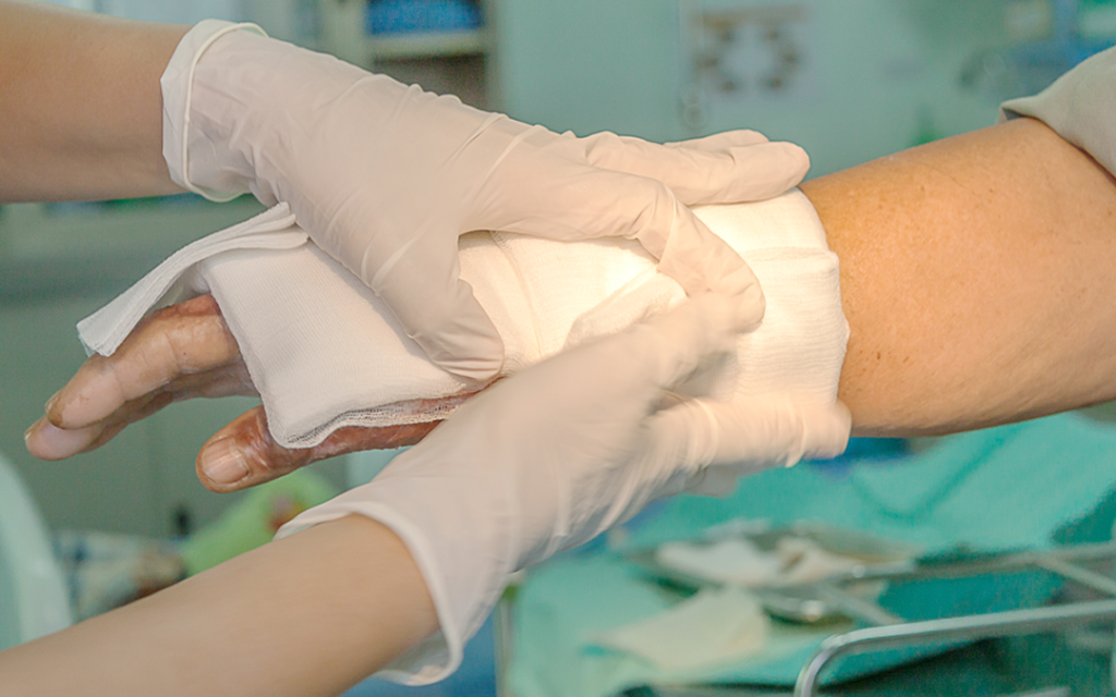 Terapia com Pressão Negativa TNP 