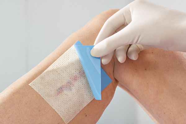 Tratamento de Feridas Complexas